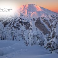 How I got into Massage Therapy in Redmond, OR